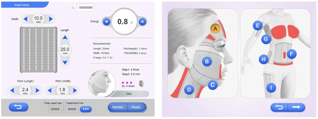 4MHz Hifu Face Lift and Body Slimming Beauty Machine